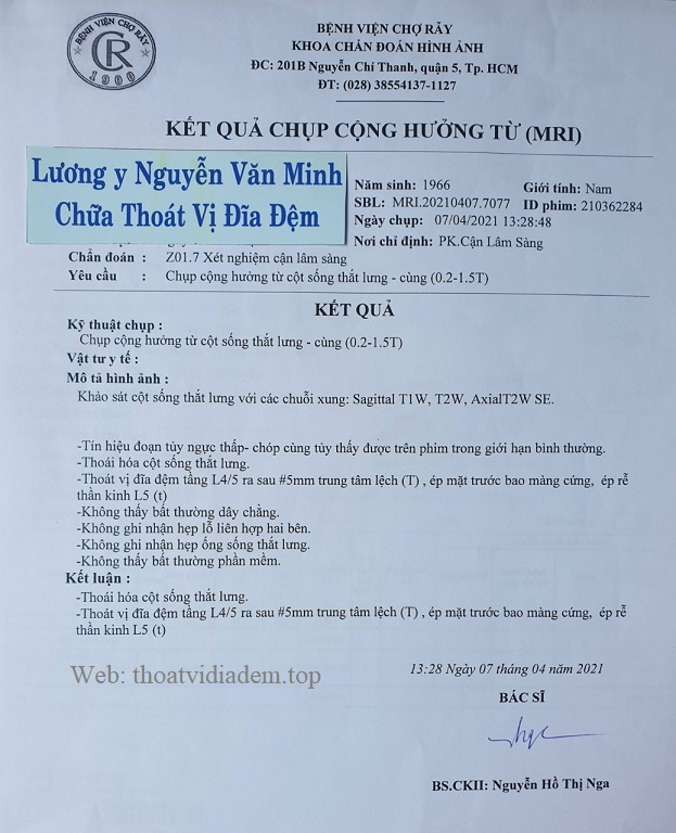 Cách trị thoát vị đĩa đệm 